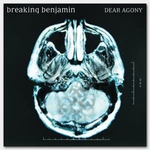 Dear Agony (japanese Edition)
